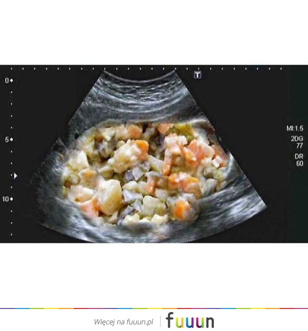 Suchar codzienny #444